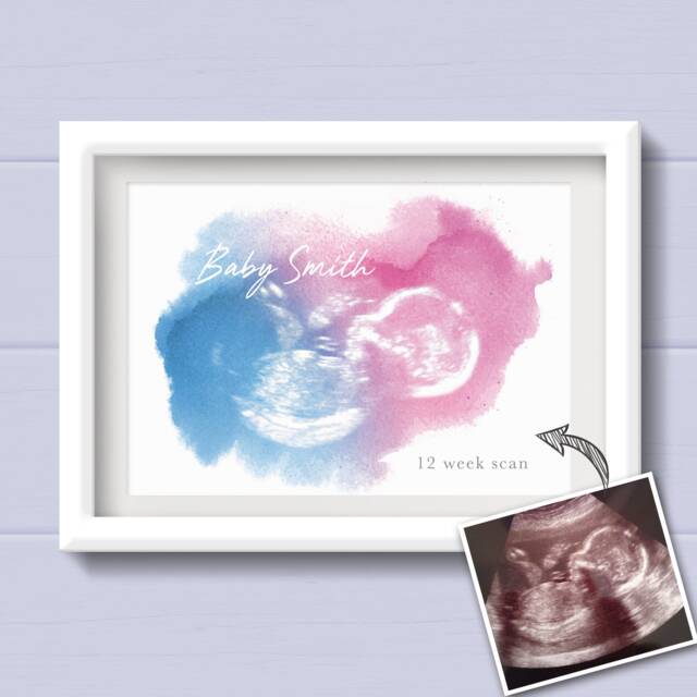 Baby Shower Gift. Gift For Mum To Be From The Bump. Pregnancy Keepsake Bump. Personalised 4D Scan Print. My First Scan - image 1