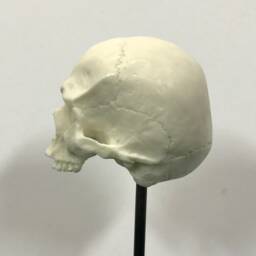 1/6Th Scale Bone Missing Middle Teeth Resin Human Skull - thumbnail 2