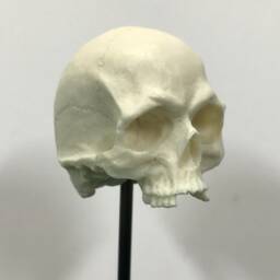 1/6Th Scale Bone Missing Middle Teeth Resin Human Skull - thumbnail 3