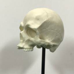 1/6Th Scale Bone Missing Middle Teeth Resin Human Skull - thumbnail 4