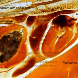 Real Anatomical Ttt - Sheet Plastinate Plastinated Anatomy Specimen By Dr. Von Horst Exhibition Quality Acrylic Embedded Body Slice - thumbnail 3