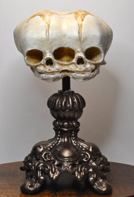 Conjoined Twins Fetal Skull Display - Gothic Anatomical Art Sculpture, Hand Painted Resin, Victorian Oddities, Curiosity Cabinet Decor - image 1
