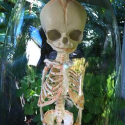 Human Fetal Skelton in Glass Cloche Dome - thumbnail 2