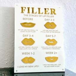 Lip Filler Journey 3D Acrylic Sign - Aesthetics Display Signage Beauty Clinic Wall Decor Salon Information A3 Size - thumbnail 3