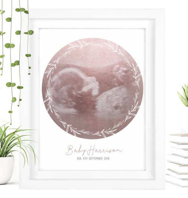 Framed Watercolour Baby Scan Print Art, Frame, Shower Gift, Ultrasound Photo, Mothers Day Gift From Bump - image 1