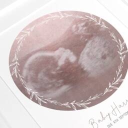 Framed Watercolour Baby Scan Print Art, Frame, Shower Gift, Ultrasound Photo, Mothers Day Gift From Bump - thumbnail 2