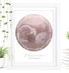 Framed Watercolour Baby Scan Print Art, Frame, Shower Gift, Ultrasound Photo, Mothers Day Gift From Bump - thumbnail 1